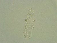 Diphascon alpinum image
