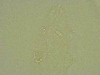 Diphascon alpinum image