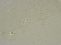 Diphascon alpinum image