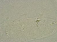 Diphascon alpinum image