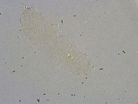 Diphascon alpinum image