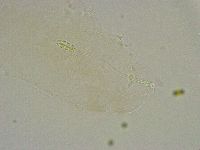 Diphascon alpinum image