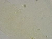 Diphascon alpinum image