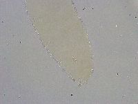 Diphascon alpinum image