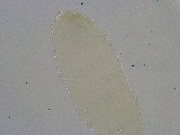 Diphascon alpinum image