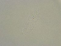 Diphascon alpinum image