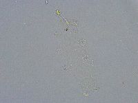 Diphascon alpinum image