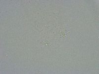Diphascon alpinum image