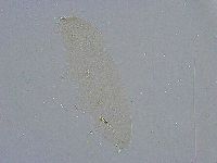 Diphascon alpinum image