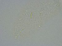 Diphascon alpinum image
