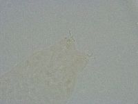 Diphascon alpinum image