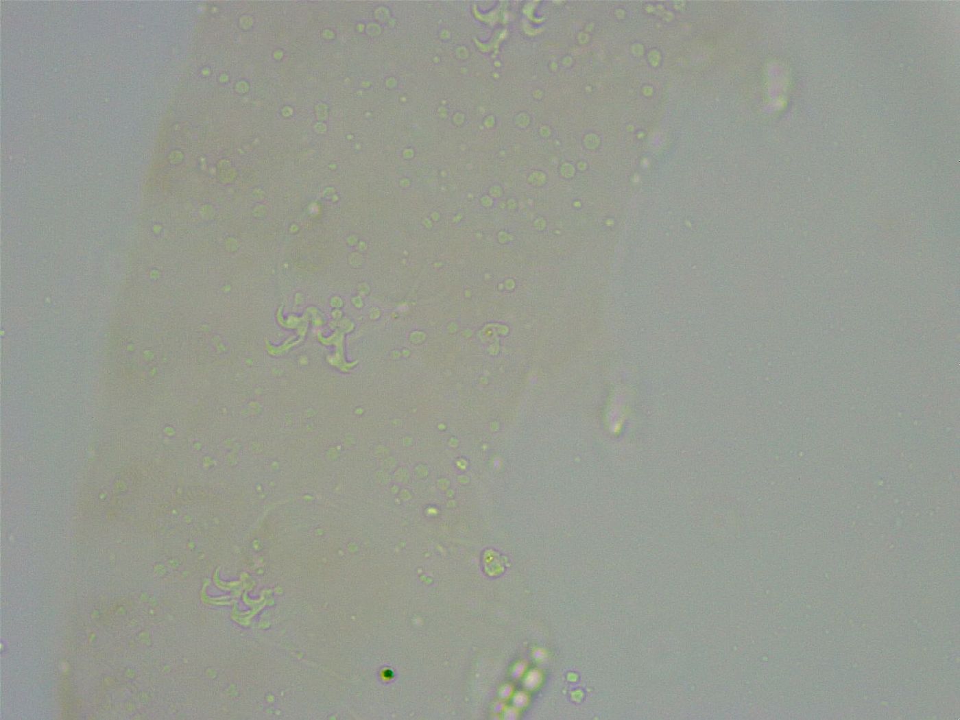 Diphascon alpinum image