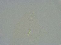 Diphascon alpinum image