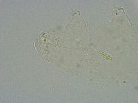 Diphascon alpinum image