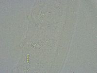 Diphascon alpinum image