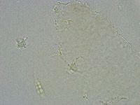 Diphascon alpinum image
