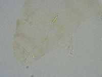Diphascon alpinum image