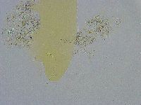 Diphascon alpinum image