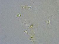 Platicrista angustata image