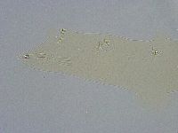 Platicrista angustata image