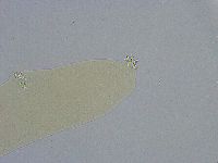 Platicrista angustata image