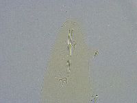 Platicrista angustata image