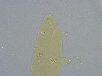 Platicrista angustata image