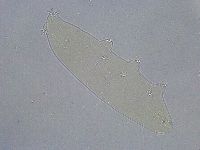 Platicrista angustata image