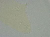 Platicrista angustata image