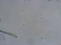 Platicrista angustata image