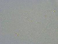 Platicrista angustata image