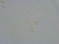 Platicrista angustata image