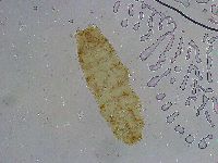 Platicrista angustata image