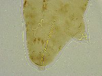 Platicrista angustata image