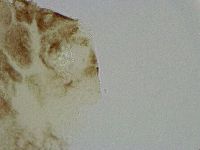 Platicrista angustata image