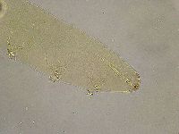 Platicrista angustata image