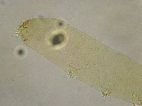 Platicrista angustata image