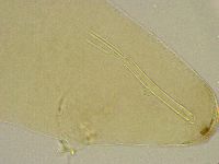 Platicrista angustata image