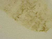 Platicrista angustata image