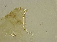 Platicrista angustata image