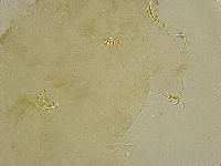 Platicrista angustata image