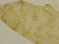 Platicrista angustata image