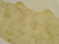 Platicrista angustata image