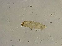 Platicrista angustata image