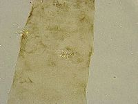 Platicrista angustata image