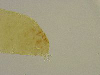 Platicrista angustata image