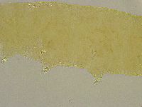 Platicrista angustata image
