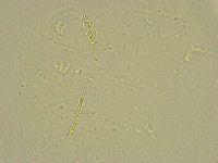 Pilatobius bullatus image