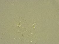 Pilatobius bullatus image