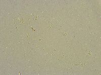 Pilatobius bullatus image
